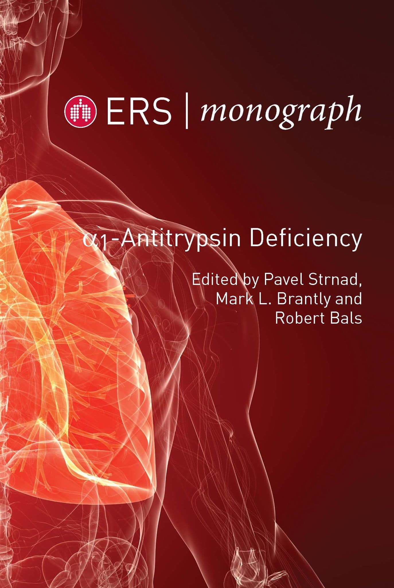 Alpha-1 Antitrypsin Deficiency – ERS Bookshop