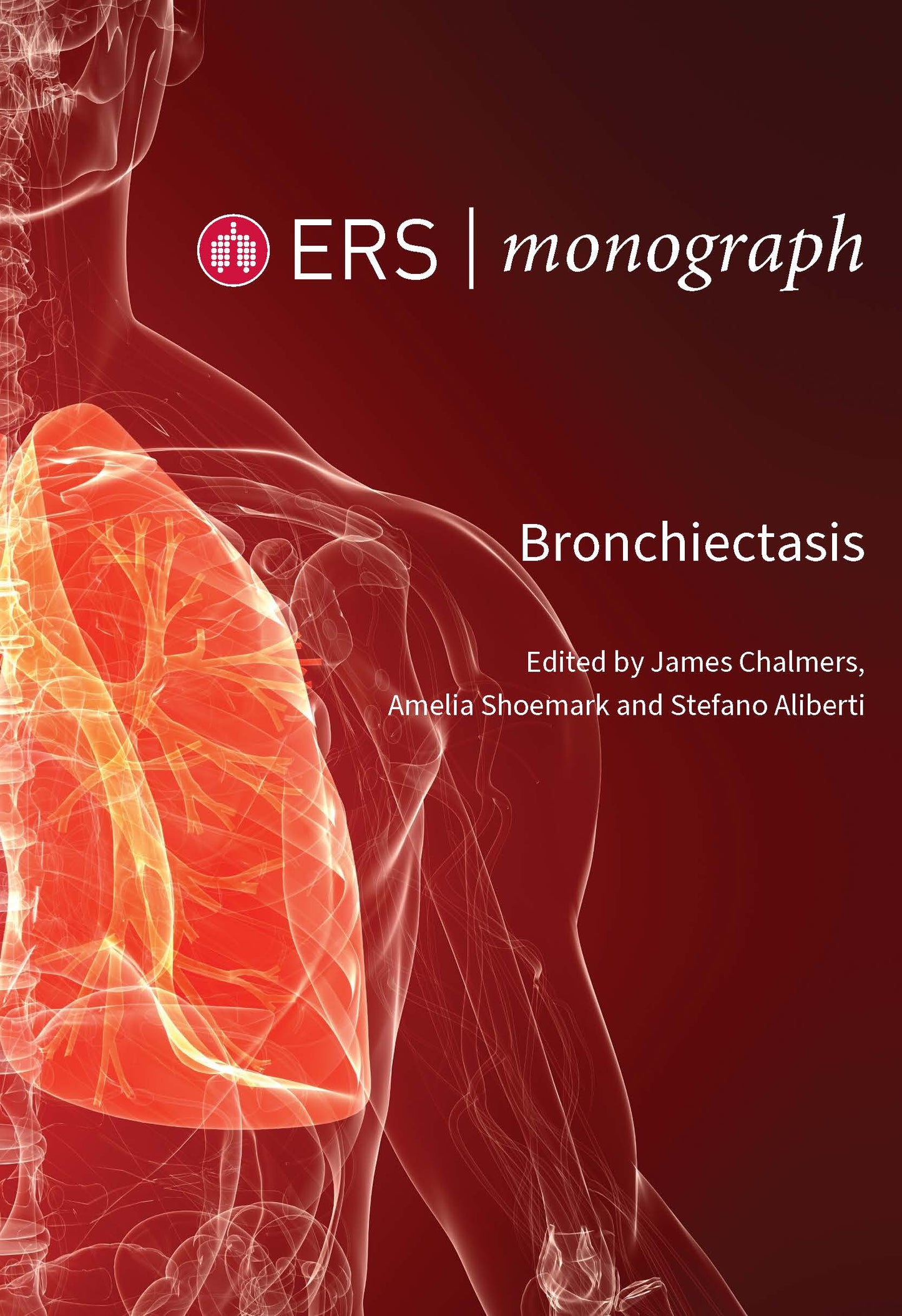 Bronchiectasis